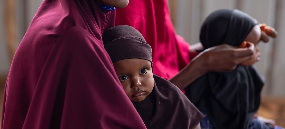 © UNICEF/Zerihun Sewunet A mother and child wait to receive treatment at a nutrition facility in Baidoa, Somalia.