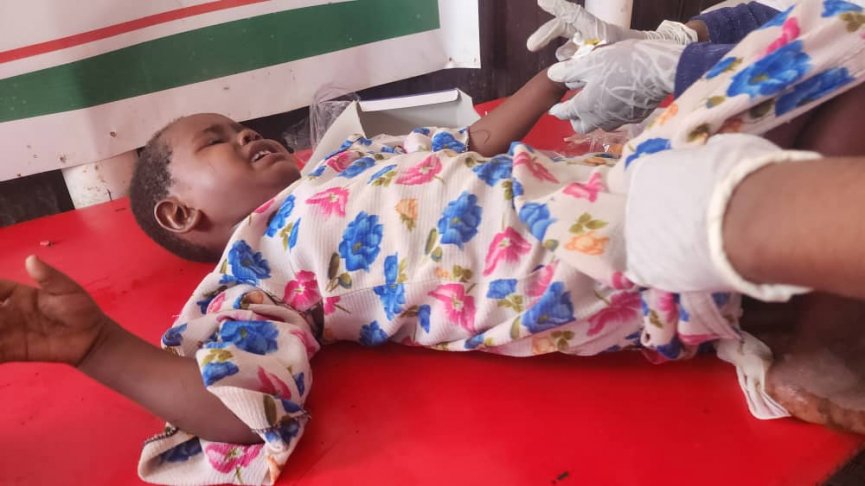 Children wounded in Turkish drone strike in Baqdaad village, Somalia on Monday, March 18, 2024. | Photo Kaab TV. Children wounded in Turkish drone strike in Baqdaad village, Somalia on Monday, March 18, 2024. | Photo Kaab TV.